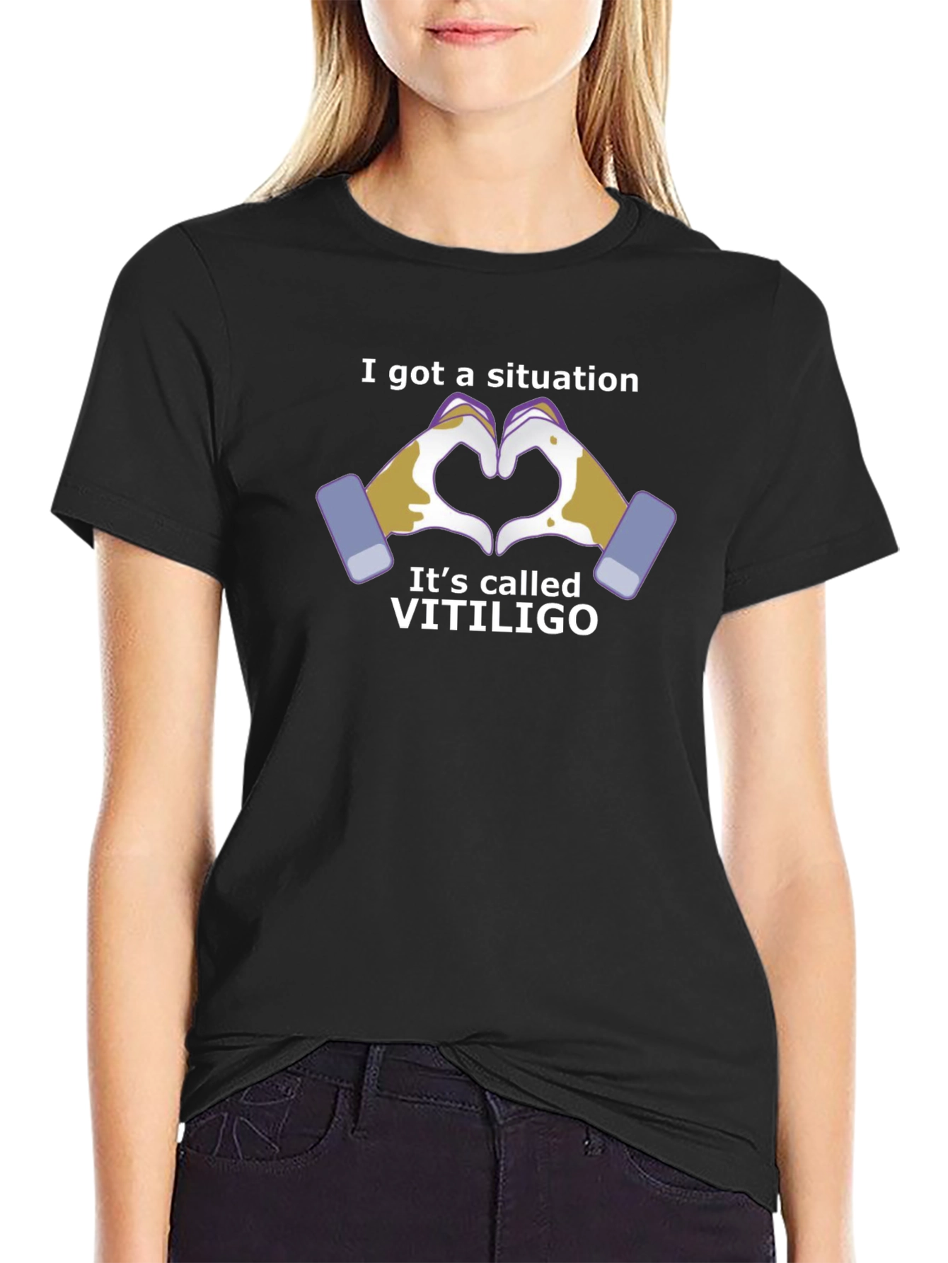 Vitiligo Awareness T-Shirt - Love & Support Tee