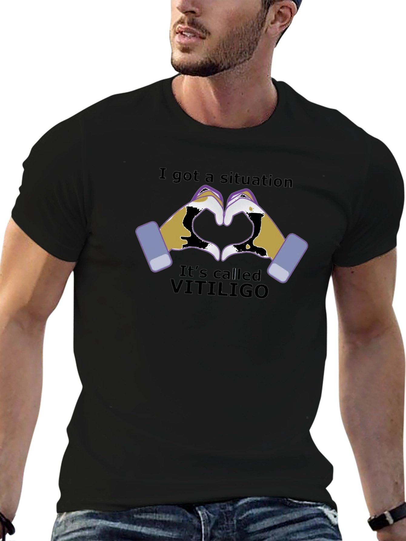 Vitiligo Awareness T-Shirt