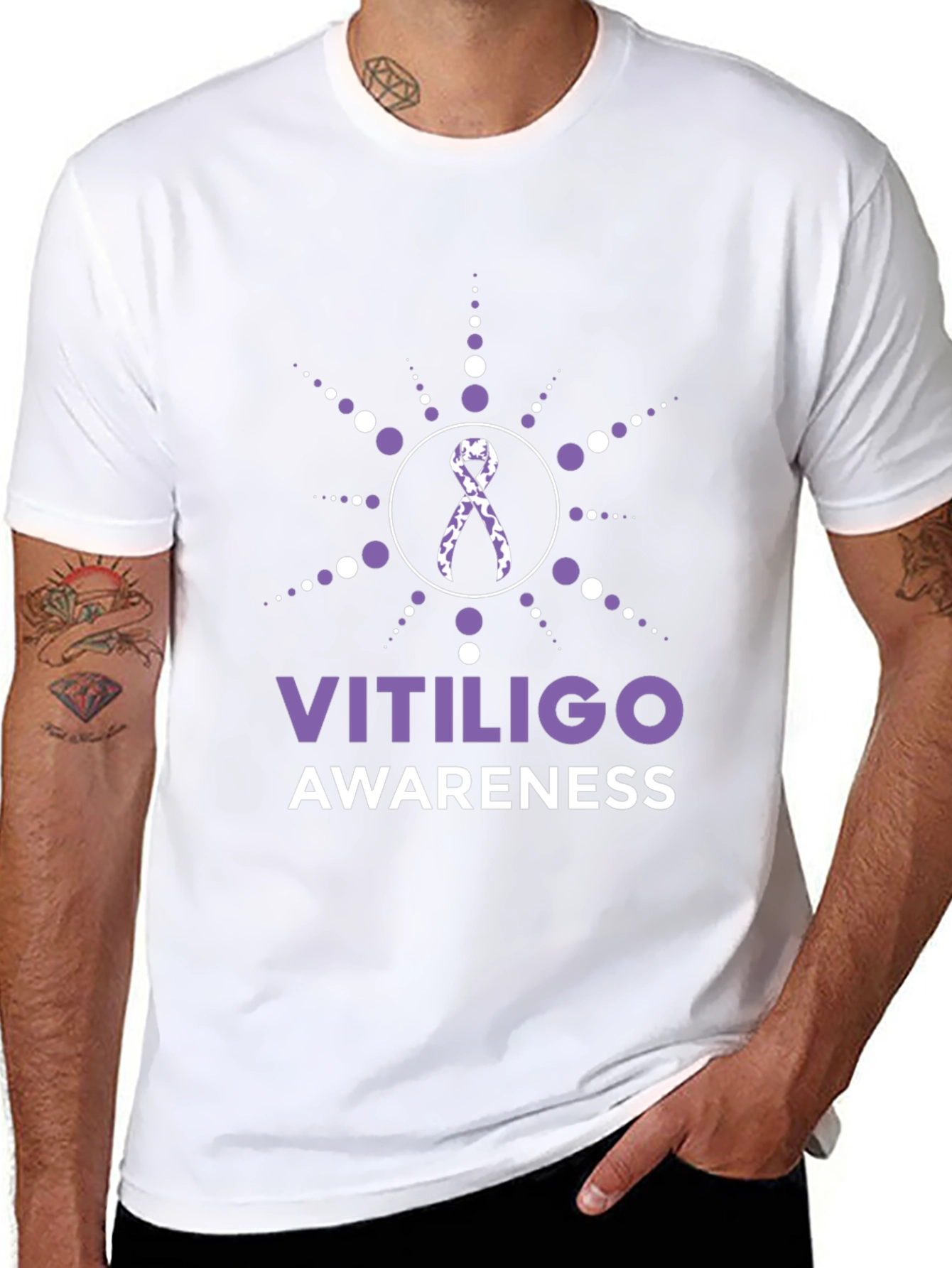 Vitiligo Awareness T-Shirt Ribbon Support