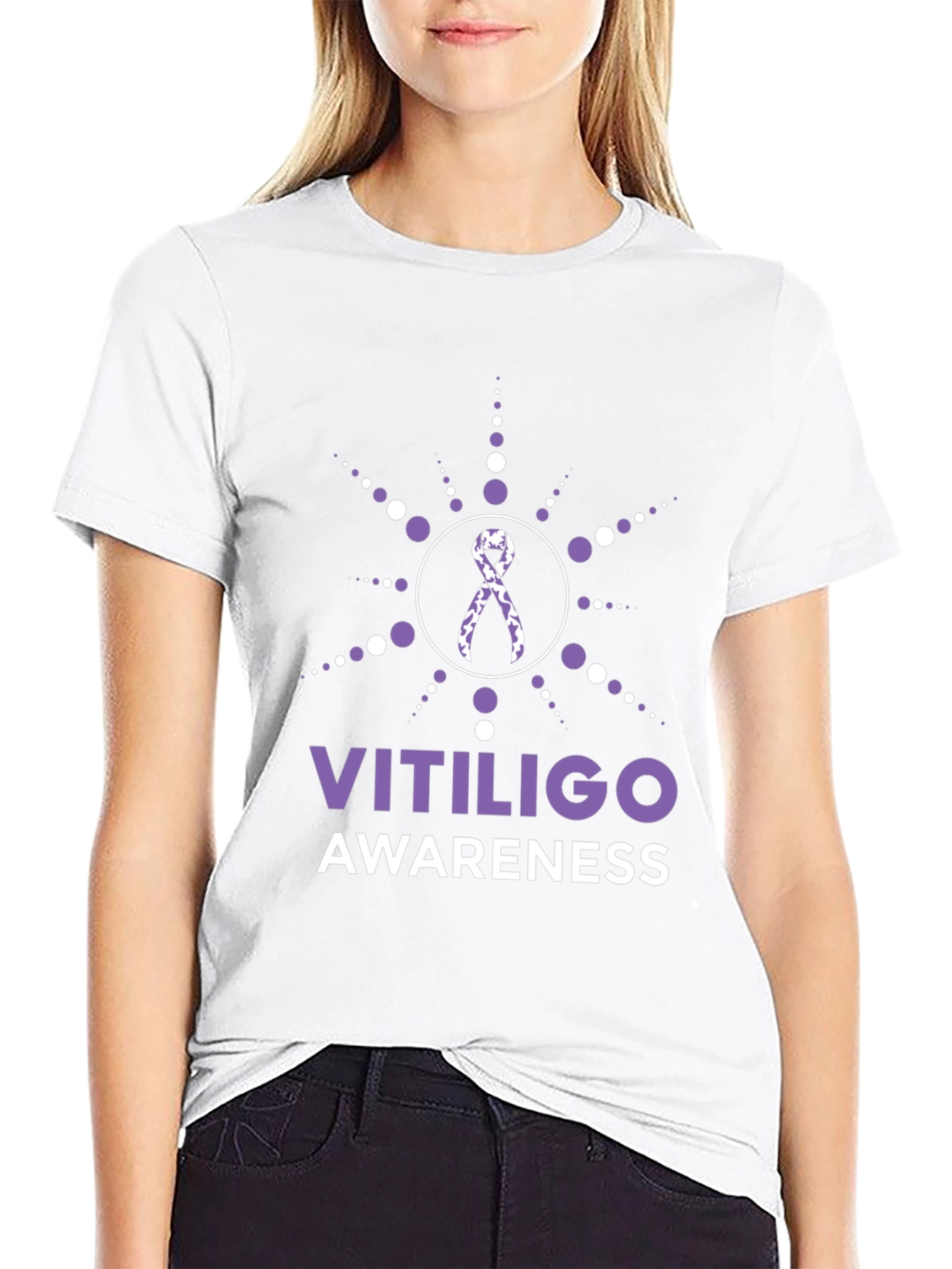Vitiligo Awareness T-Shirt Ribbon Support